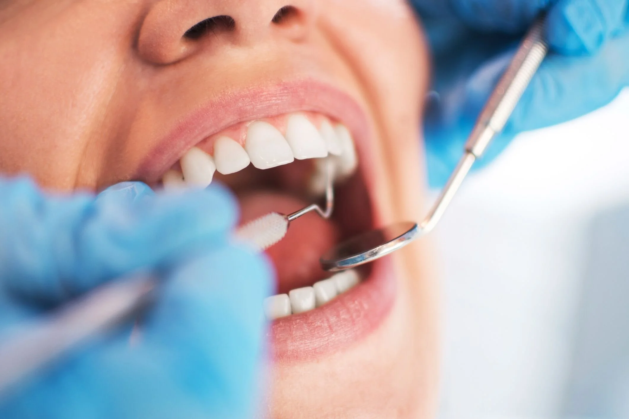 Tratamento de higiene oral - Clínica dentária na Covilhã